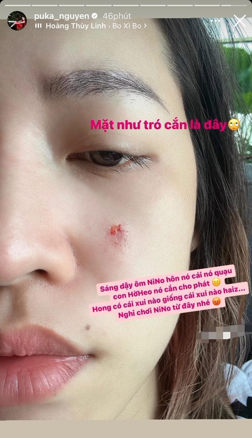 Puka bị rách mặt vì thú cưng tấn công bất ngờ Puka bị rách mặt vì thú cưng tấn công bất ngờ