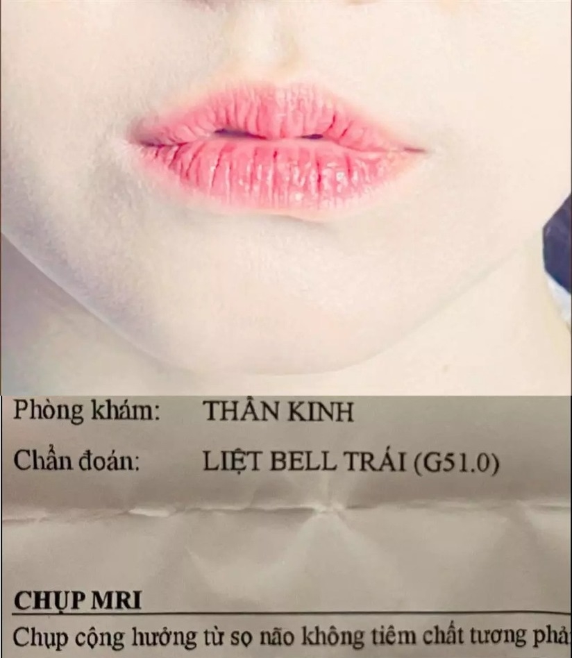 Sao Việt hôm nay 3/8: Hương Giang diện đồ cắt xẻ táo bạo ở trời Tây Sao Việt hôm nay 3/8: Hương Giang diện đồ cắt xẻ táo bạo ở trời Tây