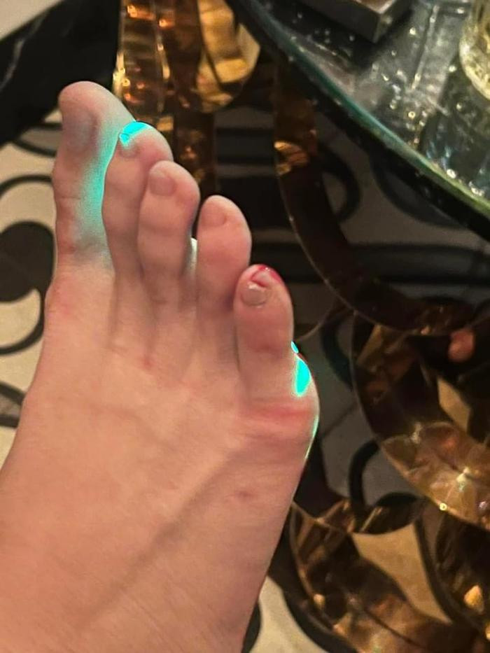 Một nữ diễn viên gặp sự cố đổ máu trong đám cưới Puka - Gin Tuấn Kiệt Một nữ diễn viên gặp sự cố đổ máu trong đám cưới Puka - Gin Tuấn Kiệt Ảnh 6